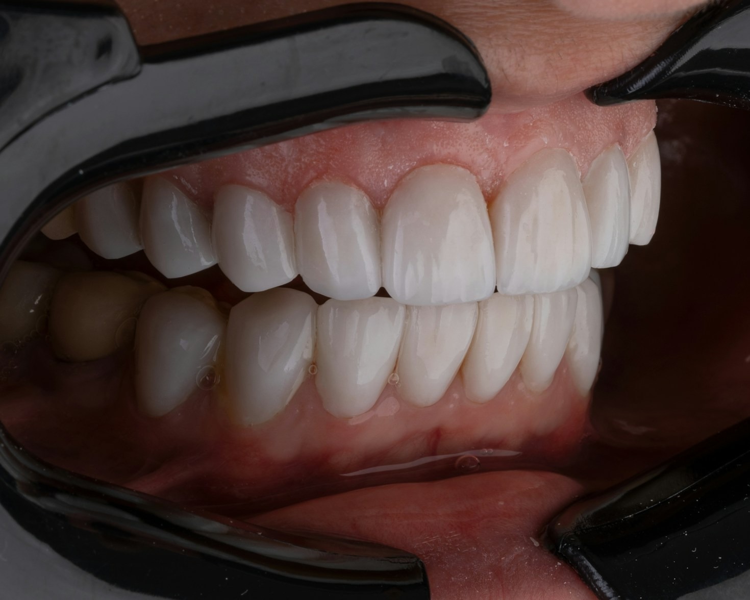 Vantagens de cuidados dentários no conforto de casa
